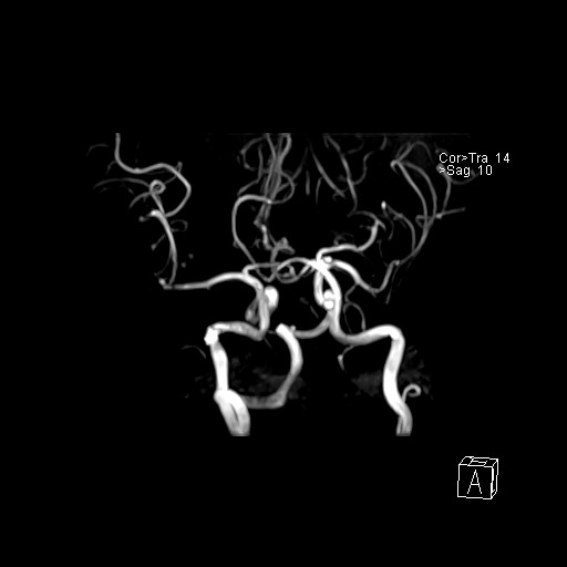 Click on the Serie image to view the images of VILLANUEVA, WILLIAM A.